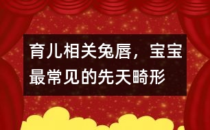 育兒相關(guān)：“兔唇”，寶寶最常見(jiàn)的先天畸形