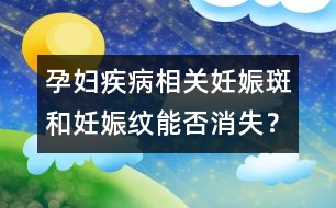 孕婦疾病相關(guān)：妊娠斑和妊娠紋能否消失？