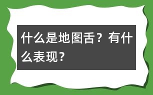 什么是地圖舌？有什么表現(xiàn)？