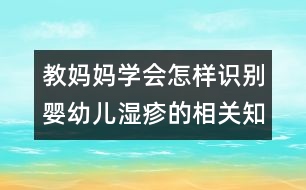 教媽媽學(xué)會怎樣識別嬰幼兒濕疹的相關(guān)知識