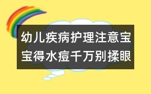 幼兒疾病護理注意：寶寶得水痘千萬別揉眼睛