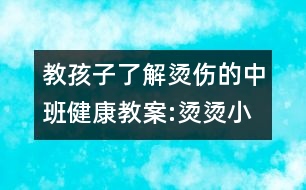 教孩子了解燙傷的中班健康教案:燙燙小魔鬼