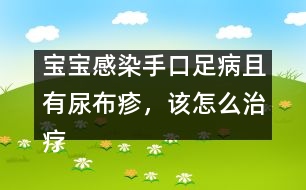 寶寶感染手口足病且有尿布疹，該怎么治療