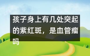 孩子身上有幾處突起的紫紅斑，是血管瘤嗎