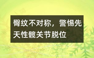 臀紋不對稱，警惕先天性髖關(guān)節(jié)脫位