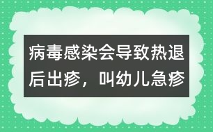 病毒感染會導(dǎo)致熱退后出疹，叫幼兒急疹